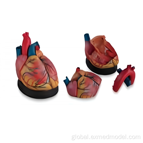 China Enlarged Heart Anatomy Model Supplier